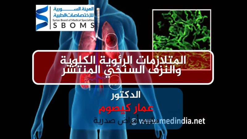 الهيئة السورية للاختصاصات الطبية المتلازمات الرئوية الكلوية والنزف السنخي المنتشر