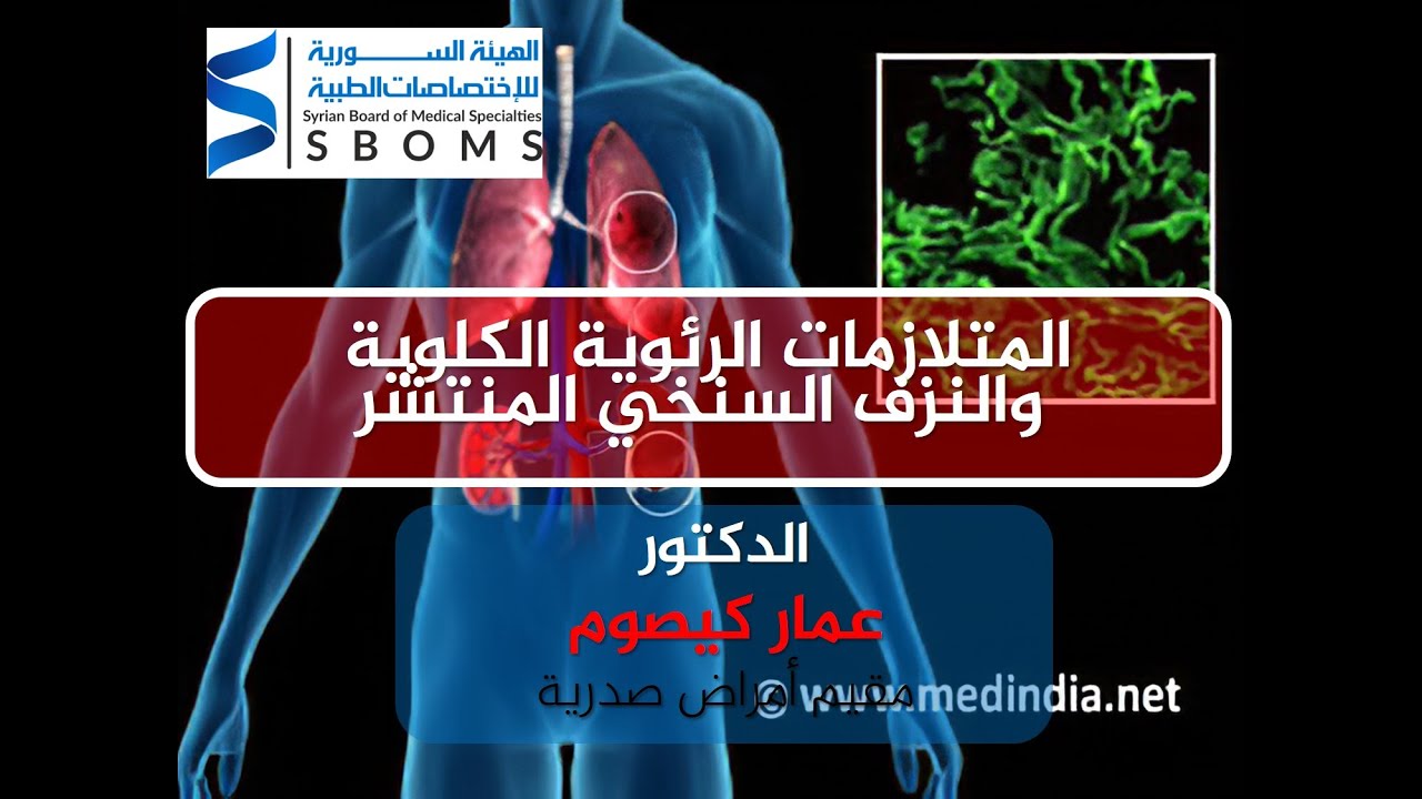 الهيئة السورية للاختصاصات الطبية المتلازمات الرئوية الكلوية والنزف السنخي المنتشر